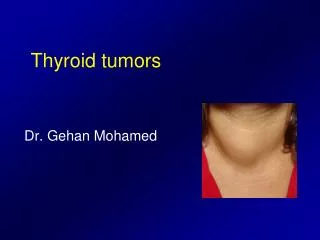 Thyroid tumors