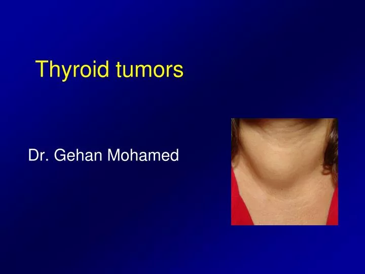 thyroid tumors