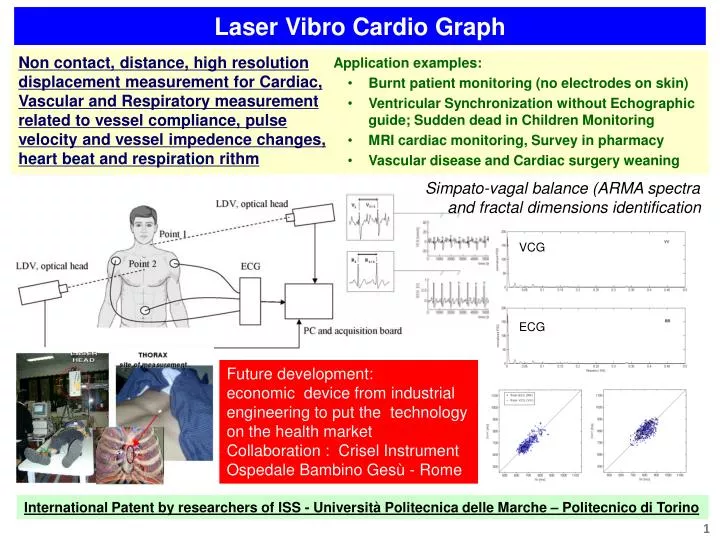 laser vibro cardio graph