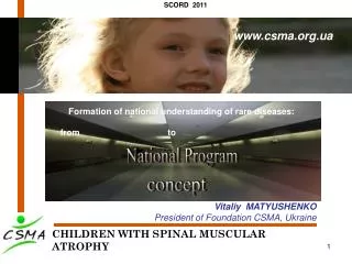 CHILDREN WITH SPINAL MUSCULAR ATROPHY