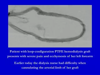 Patient with loop-configuration PTFE hemodialysis graft