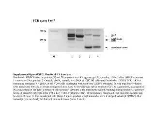 PCR exons 5 to 7