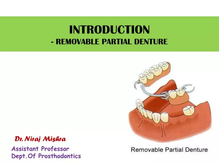 introduction removable partial denture