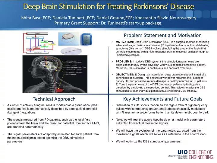 deep brain stimulation for treating parkinsons disease