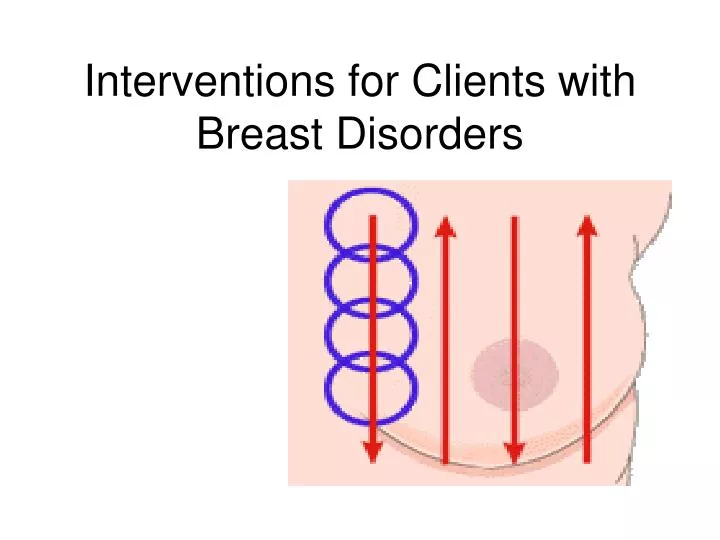 interventions for clients with breast disorders