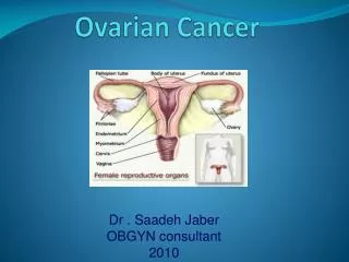 Ovarian Cancer