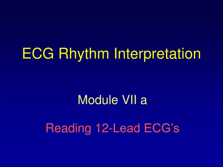 ecg rhythm interpretation