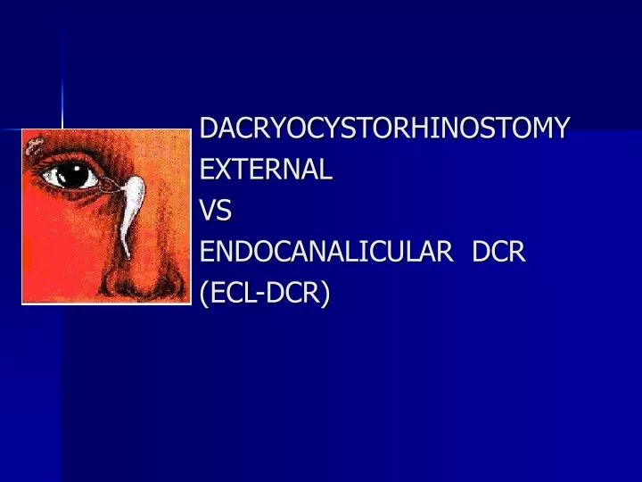 dacryocystorhinostomy external vs endocanalicular dcr ecl dcr