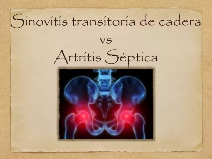 sinovitis transitoria de cadera vs artritis s ptica