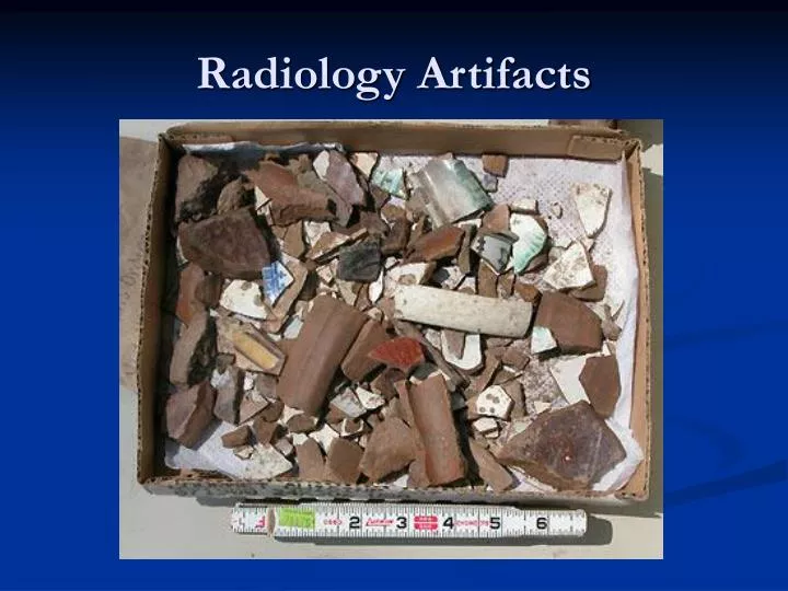 radiology artifacts