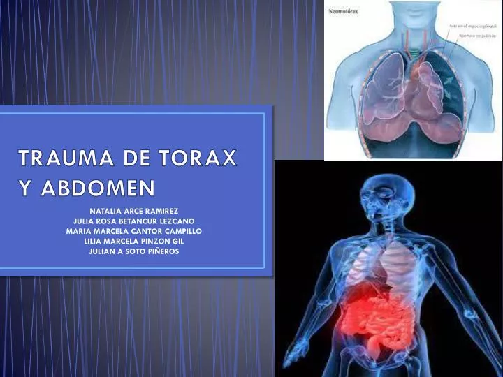 trauma de torax y abdomen