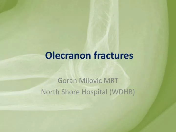 olecranon fractures