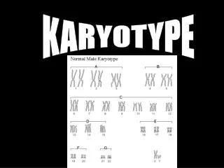 KARYOTYPE