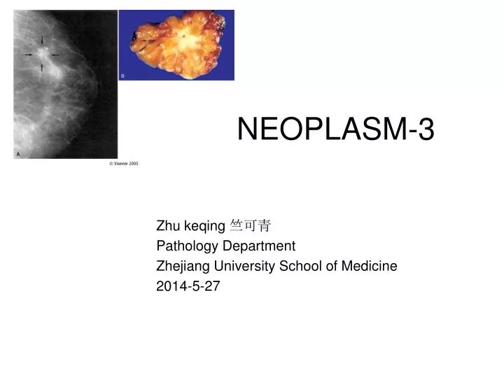 neoplasm 3