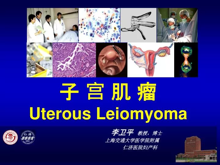 uterous leiomyoma