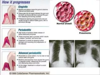 Burton's Microbiology for the Health Sciences Chapter 18. Viral Infections