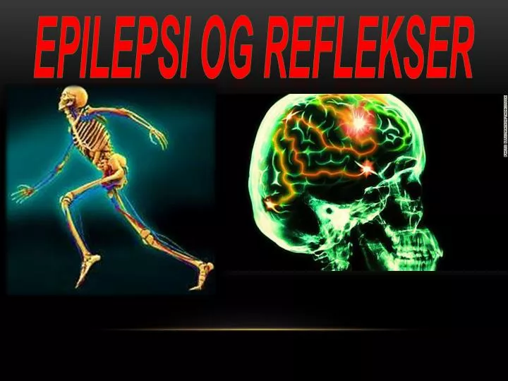epilepsi og reflekser