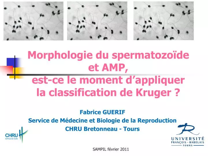 morphologie du spermatozo de et amp est ce le moment d appliquer la classification de kruger