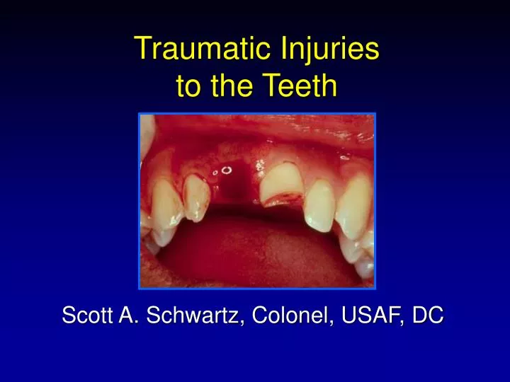 traumatic injuries to the teeth