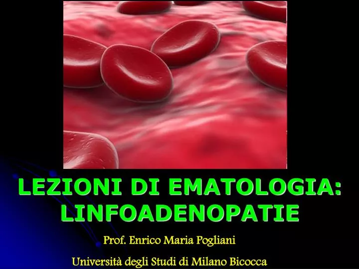 lezioni di ematologia linfoadenopatie