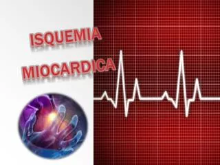 isquemia miocardica