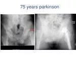 75 years parkinson