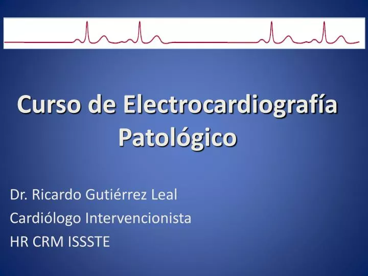 curso de electrocardiograf a patol gico