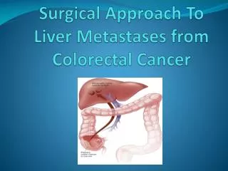 Surgical Approach To Liver Metastases from Colorectal Cancer
