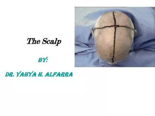 The Scalp BY: DR. Yahya h. Alfarra