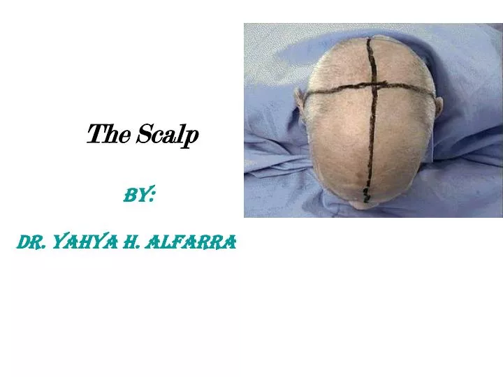 the scalp by dr yahya h alfarra