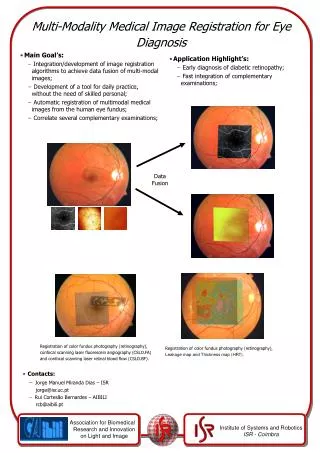 Multi-Modality Medical Image Registration for Eye Diagnosis