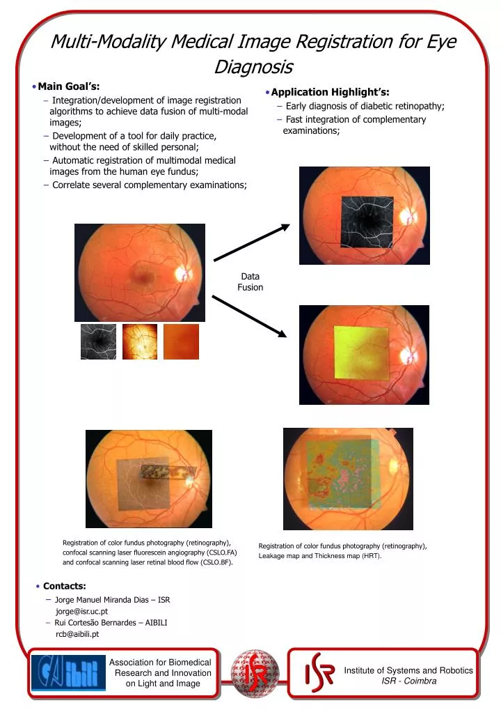 multi modality medical image registration for eye diagnosis