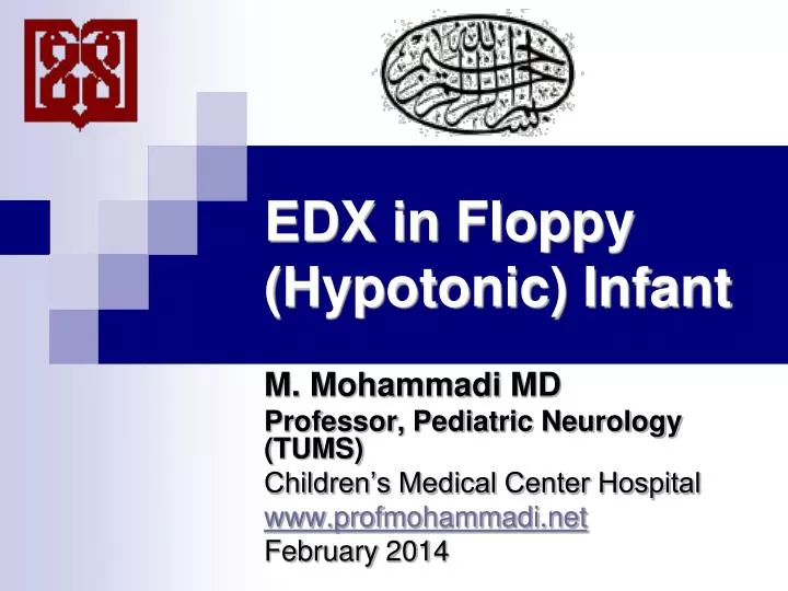 edx in floppy hypotonic infant