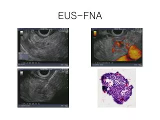 eus fna