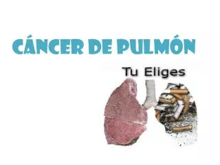 c ncer de pulm n