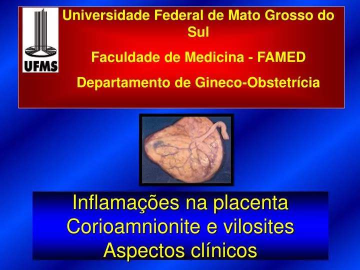 inflama es na placenta corioamnionite e vilosites aspectos cl nicos