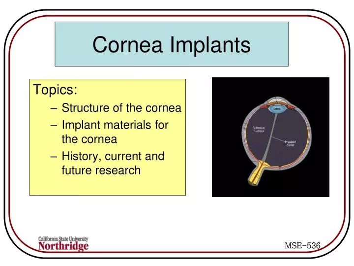 cornea implants