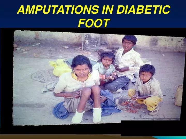 amputations in diabetic foot