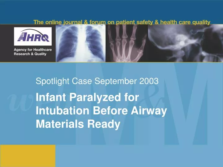 spotlight case september 2003