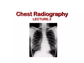 Chest Radiography LECTURE.2