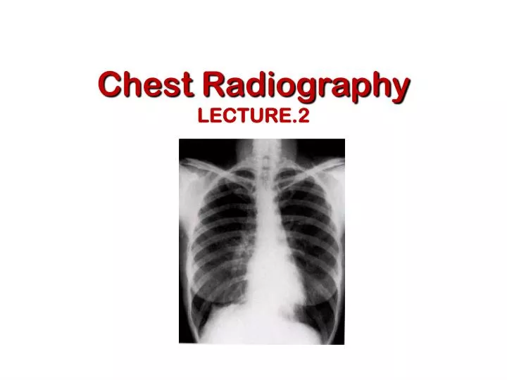 chest radiography lecture 2