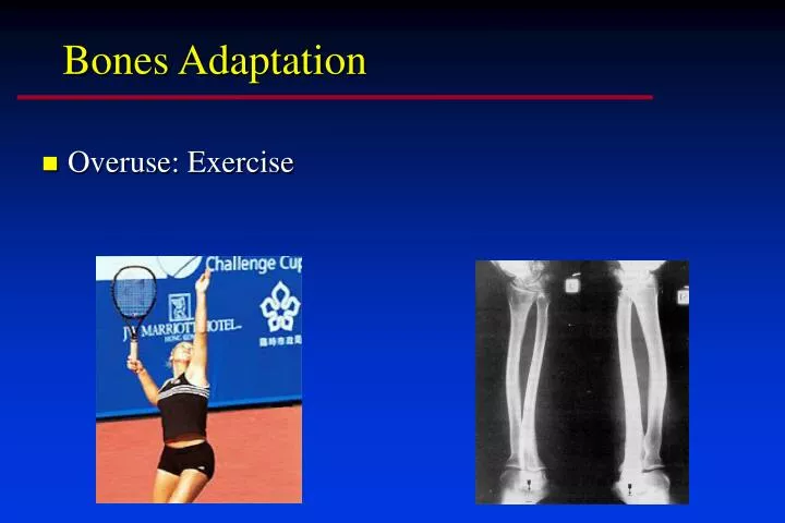bones adaptation