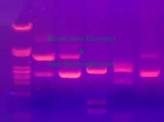 Restriction Enzymes &amp; Gel Electrophoresis