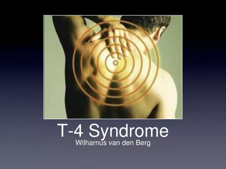 t 4 syndrome