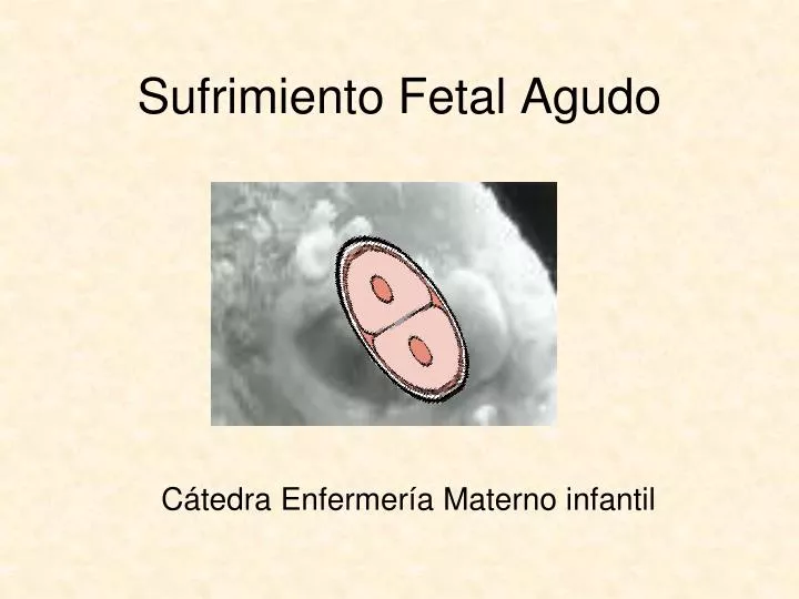 sufrimiento fetal agudo