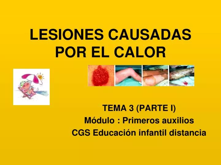 lesiones causadas por el calor