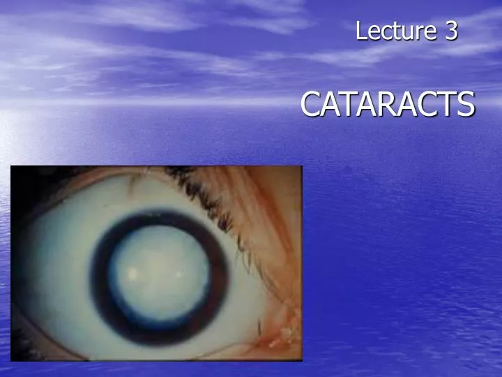 lecture 3 cataracts