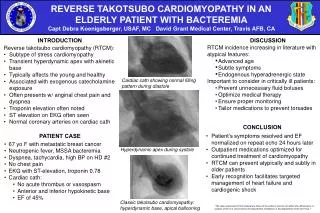Reverse takotsubo cardiomyopathy (RTCM): Subtype of stress cardiomyopathy