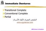 Immediate Dentures - slide 1