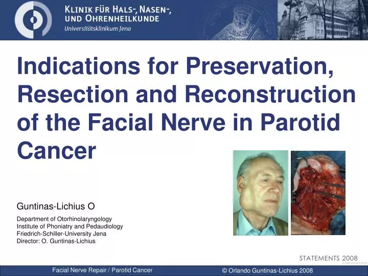 indications for preservation resection and reconstruction of the facial nerve in parotid cancer